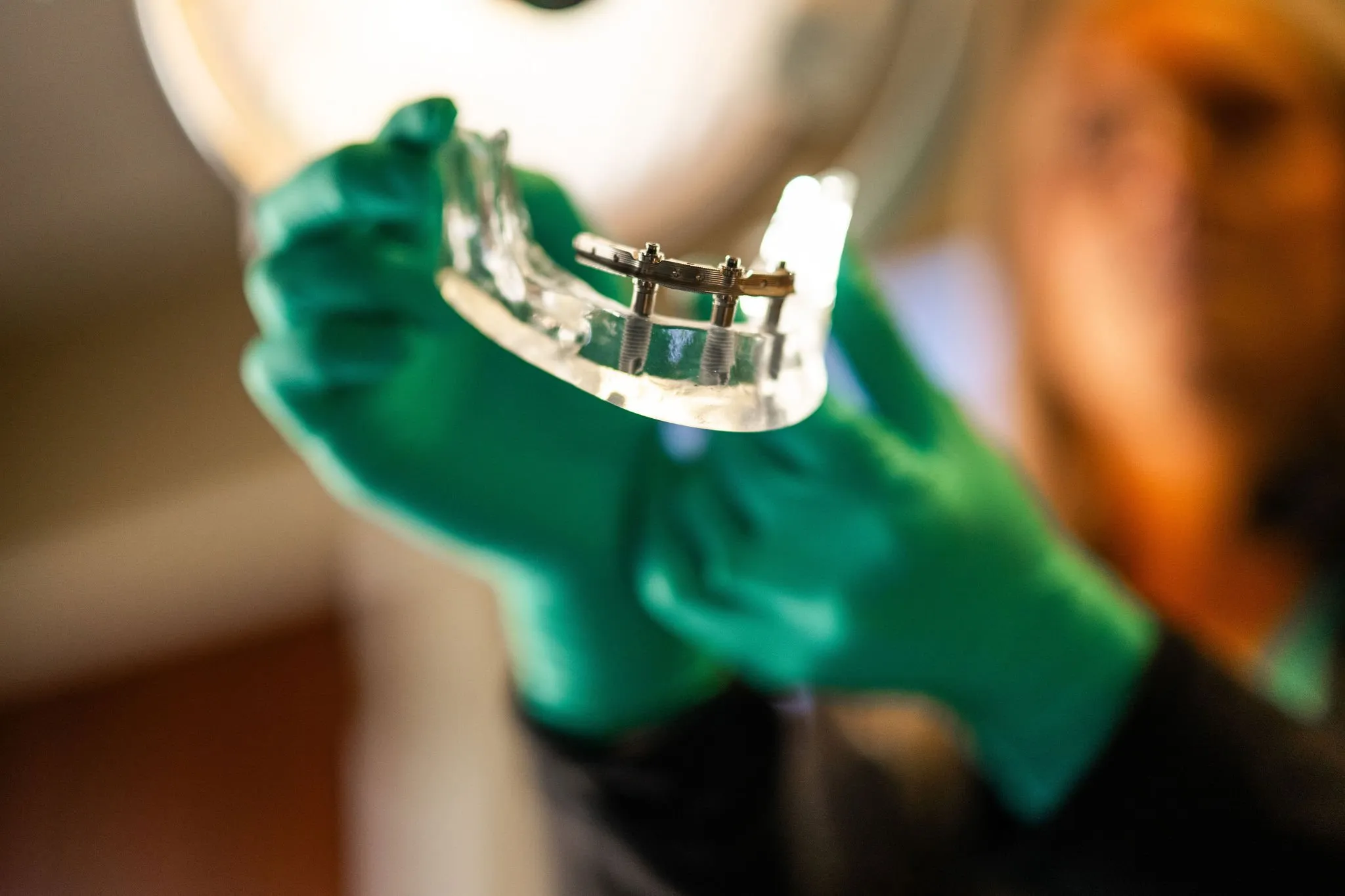 Mini Dental Implants | Lake Norman Oral & Facial Surgery, Huntersville, NC