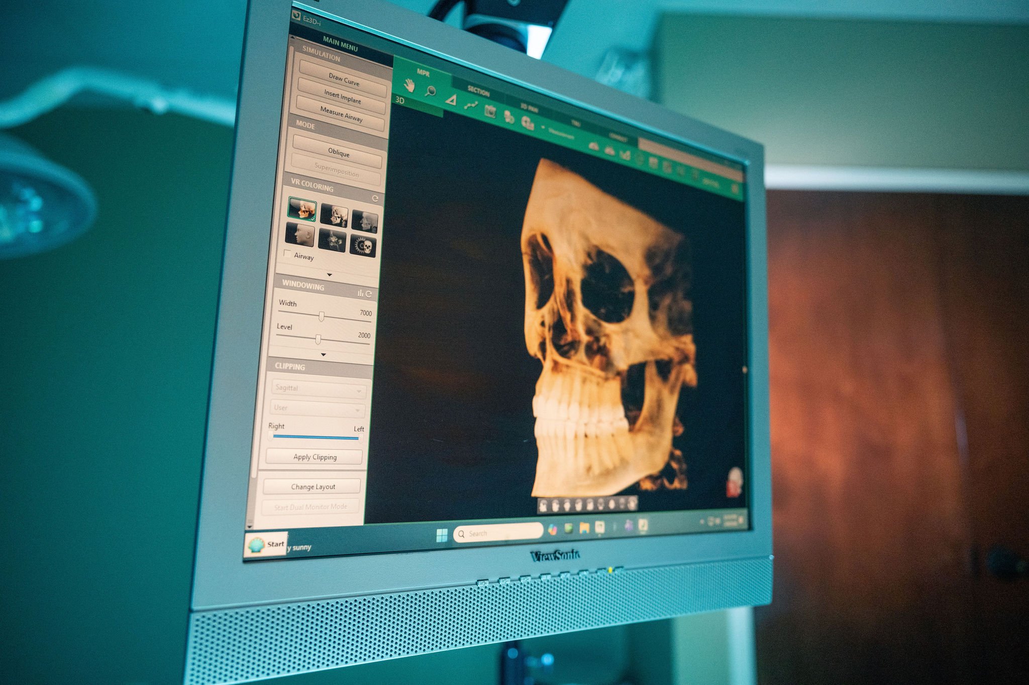 Facial Plastic Surgery | Lake Norman Oral & Facial Surgery, Huntersville, NC